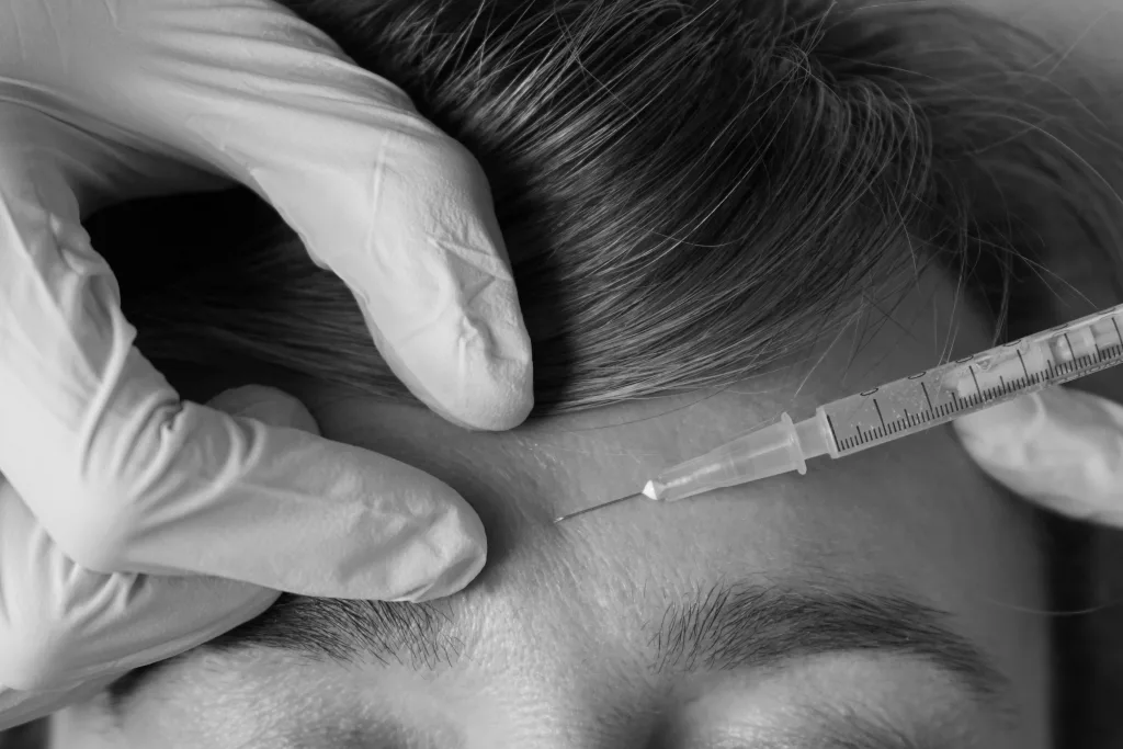 Aplicação de Botox (uso terapêutico)