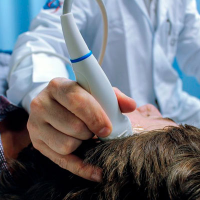 Doppler Transcraniano